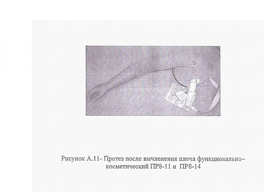 Functional-Cosmetic Prosthesis for Shoulder Disarticulation PR8-11