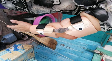 جهاز مفصل الكوع orthopedic