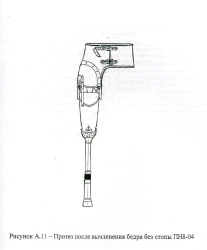 Prosthetic for Hip Disarticulation, PN8-04