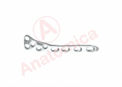 Tibial Plateau Support Plate with Angular Stability for Large Tibia Bone