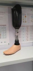 Modular Shin Prosthesis with Silicone Cover