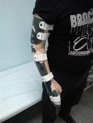 Orthopedic Devices for Wrist and Elbow Joints - Fixing and Correcting