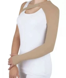 Orthopedic Bandage for Upper Limb Lymphovenous Drainage after Mastectomy