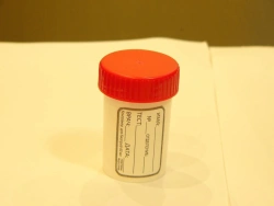 Disposable Sterile Polymer Container for Biological Samples - 60ml with Spoon and Label