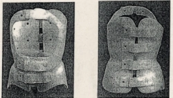 Rigid Support Corset for Thoracolumbar Spine KRO-270