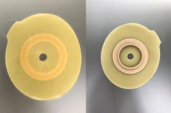 Stoma Rehabilitation Aid for Colostomy, Ileostomy, and Urostomy: Flat and Convex Plates