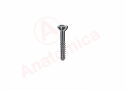 Rod Tension Screw for Bone Fracture Fixation