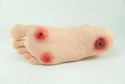 Soft Diabetic Foot Model for Education - ROST-S19