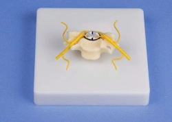 Enlarged Cross-Section Model of Spinal Cord 18104