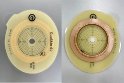 Stoma Care Rehabilitation Product for Colostomy, Ileostomy, and Urostomy: Flat Plate, Convex Plate
