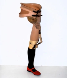 Non-Modular Hip Prosthesis PN8-N.1 for Hip Disarticulation