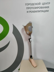 Modular Hip Prosthesis for Congenital Underdevelopment