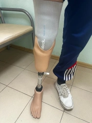 Modular Lower Leg Prosthesis for Underdevelopment