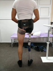 Modular Thigh Amputation Prosthesis