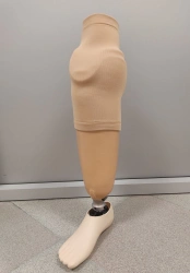 Modular Lower Leg Prosthesis for Amputation Defects