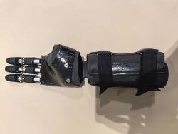 Microprocessor-Controlled Hand Prosthesis