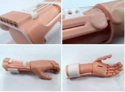 Active Prosthetic Hand (Traction Type) PR0-T-OK