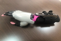 Active Hand Prosthesis for Partial Hand Amputation