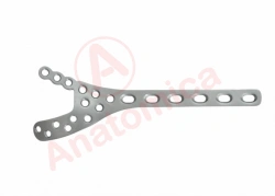 Distal Humerus Plate for Bone Fracture Stabilization