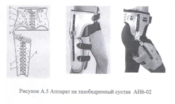 Hip Joint Orthosis Device AN6-02