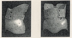 Lumbar-Sacral Rigid Stabilization Corset KР0-273