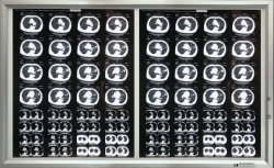Medical Negatoscope for Viewing X-ray Images, Model TU 9452-001-11349579-2016