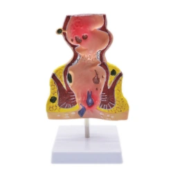 Anatomical Model of the Rectum, 12007