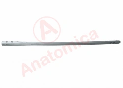 Antegrade-Retrograde Intramedullary Nail for Femur