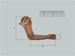 Microprocessor-Controlled Prosthetic Arm