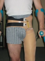 Modular Hip Disarticulation Prosthesis