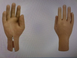 Cosmetic Hand Prosthesis for Partial Hand Amputation