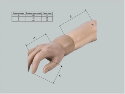 Custom Cosmetic Hand Prosthesis for Partial Hand Amputation