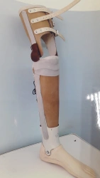 Non-Module Below-Knee Prosthesis PN3-N.1