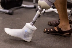 Modular Below-Knee Prosthesis with Microprocessor-Controlled Foot Module