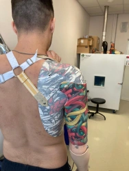 Electromechanical Shoulder Prosthesis with Control System