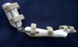 Joint Rehabilitation Device for Wrist, Elbow, and Shoulder AR2-14-OK