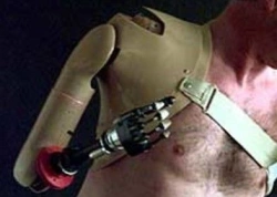 Electromechanical Arm Prosthesis with Control Contact System, PR8-BOB