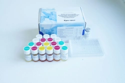 Diagnostic Reagent Kit for Urogenital Infections and Antibiotic Sensitivity Testing Uro-Test