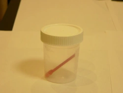 Disposable Sterile Polymer Container for Biological Samples - KOP 125ml with Spoon