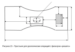 Disposable Urological Surgery Sheet with "Mesh" Filter