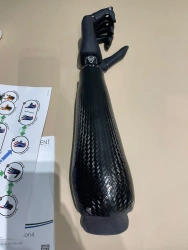 Microprocessor-Controlled Forearm Prosthesis