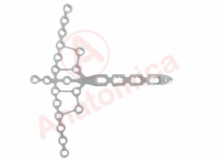 Pilon Reconstruction Plate with Angular Stability