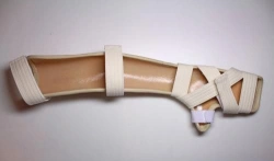 Full Arm Brace for Upper Limb Support and Correction