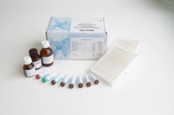 IgE Detection Kit for Quantitative Blood Serum Testing
