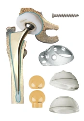 Cemented Hip Joint Prosthesis for Primary Arthroplasty - TU 9438-001-49346483-2005