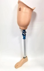 Modular Hip Prosthesis with Custom Socket for Congenital Deficiency PN6-72