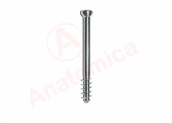 Spongy Screw for Bone Fracture Fixation, 16mm