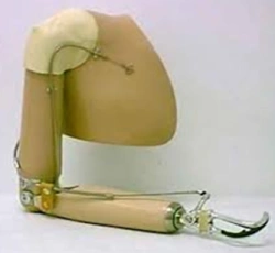 Functional Cosmetic Prosthesis for Above-Elbow Amputation