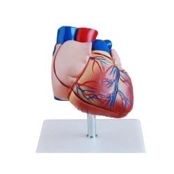 Enlarged Heart Model (3 Parts) 56018