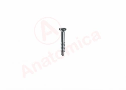 Malleolar Screw for Bone Fracture Fixation
